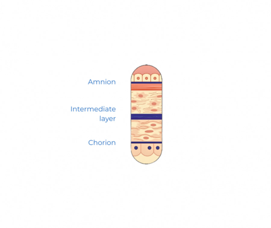 AmchoPlast membrane layers diagram
